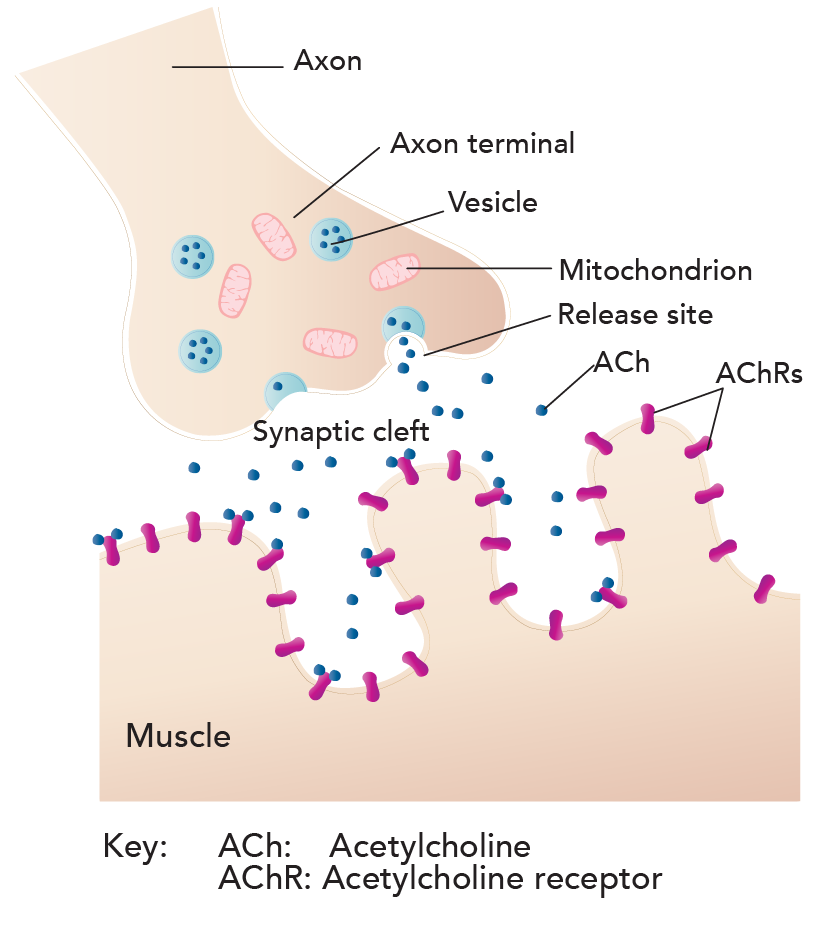 Acetylcholine Receptor Myasthenia Gravis 5415